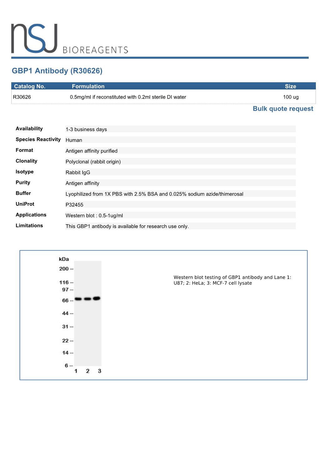 GBP1 Antibody (R30626)