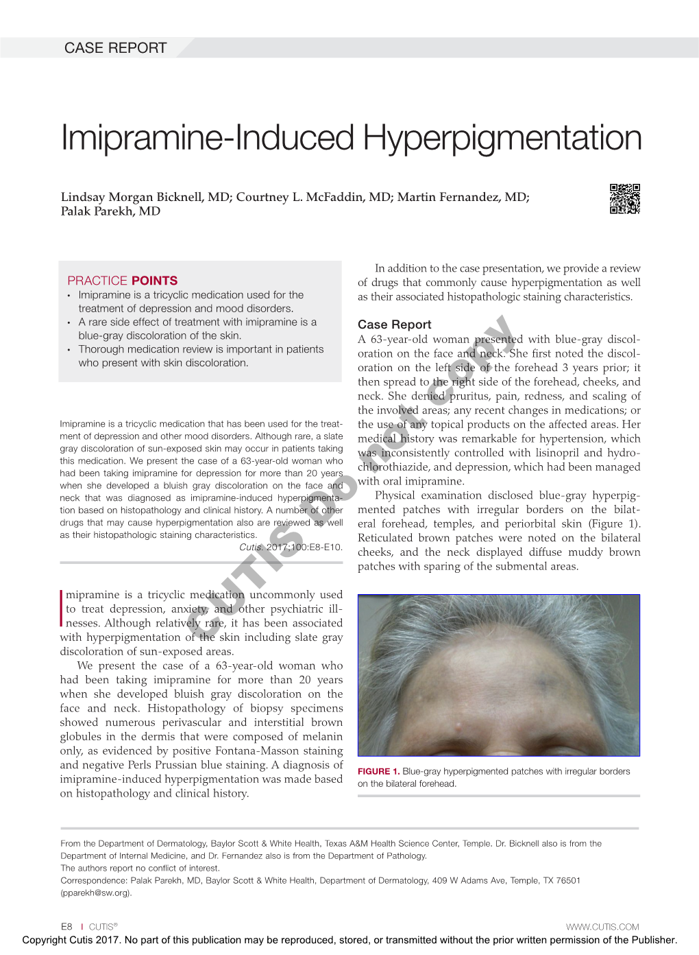 Imipramine-Induced Hyperpigmentation