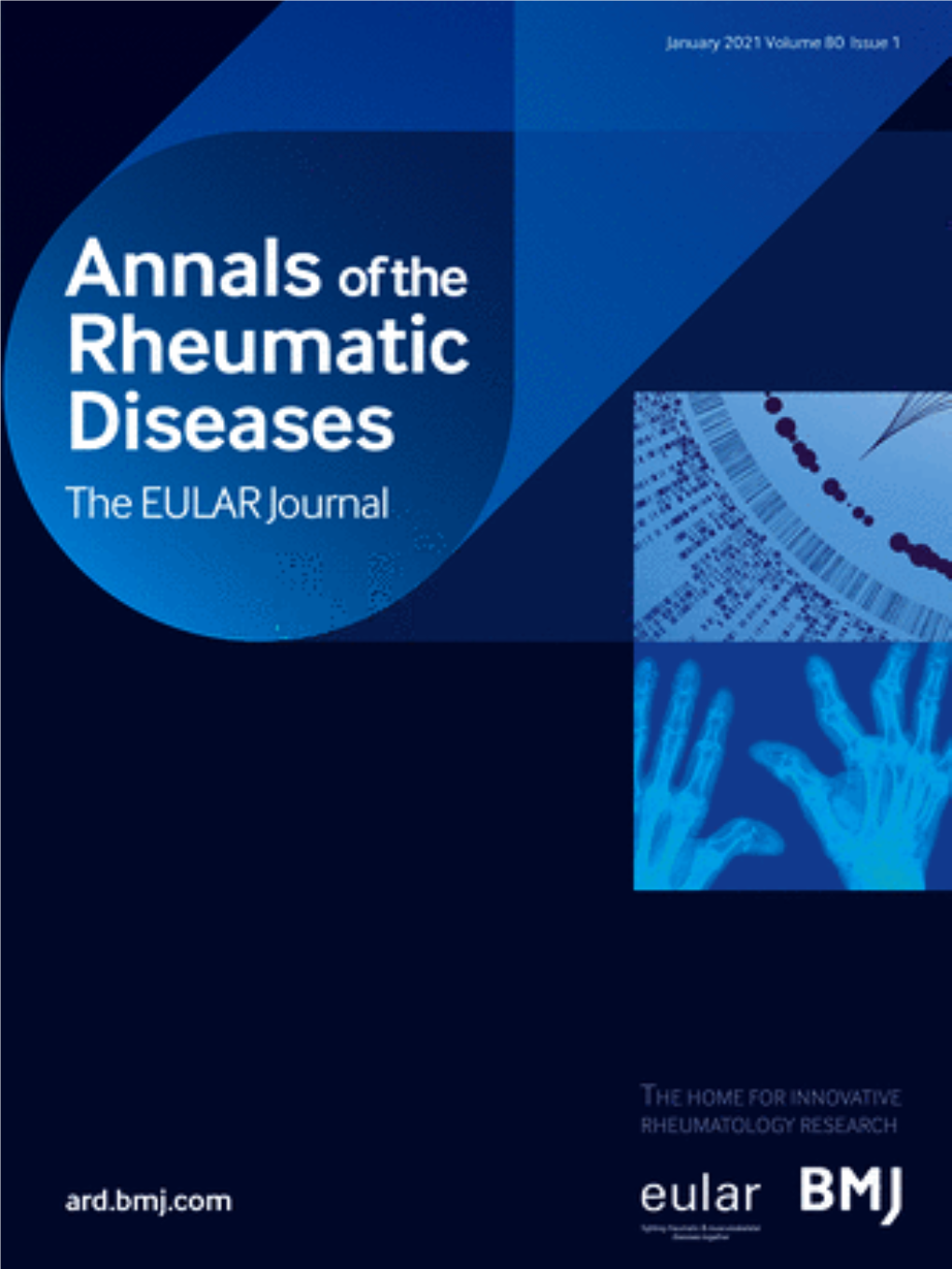 Annals of the Rheumatic Diseases 2021 1.Pdf