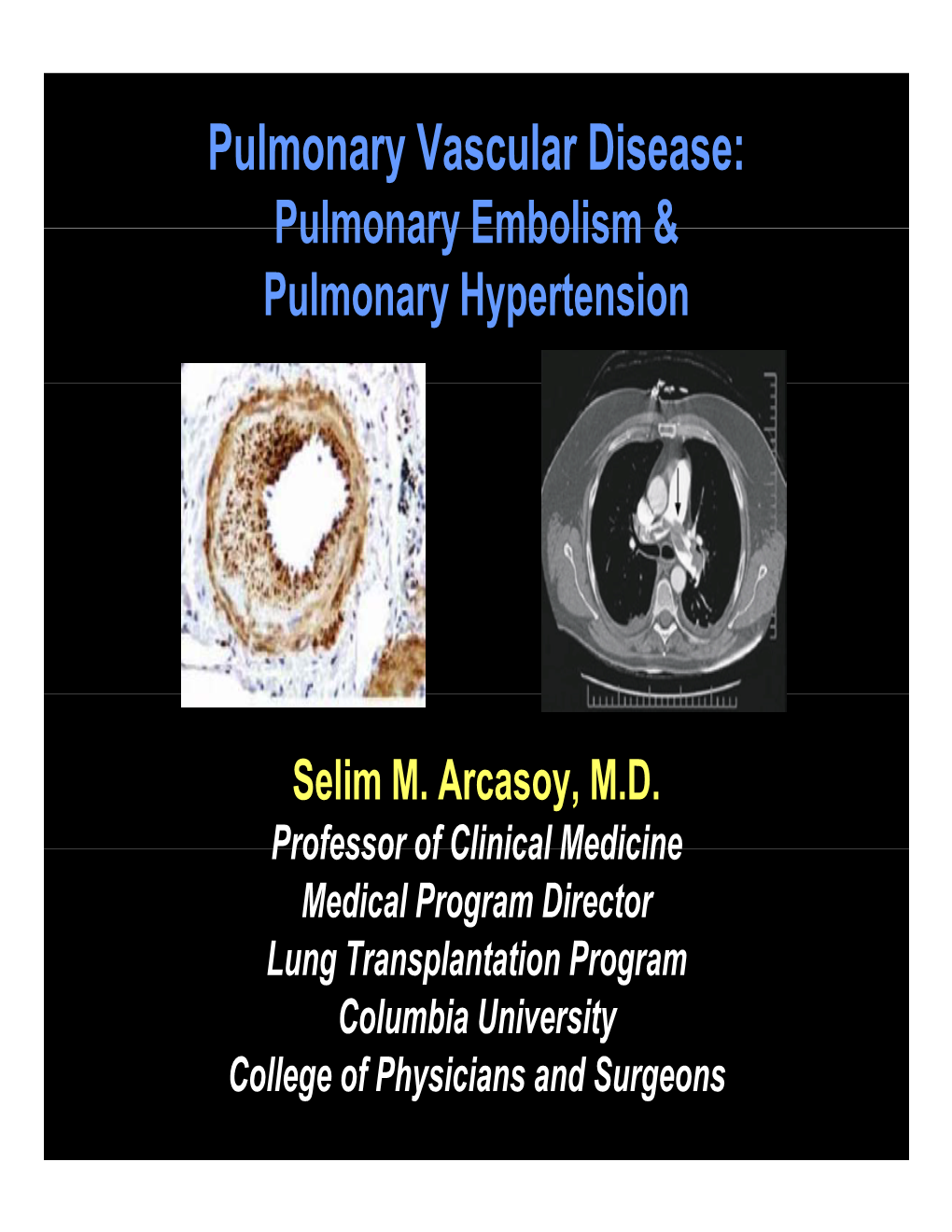Pulmonary Vascular Disease: Pulmonary Embolism & Pulmonary Hypertension
