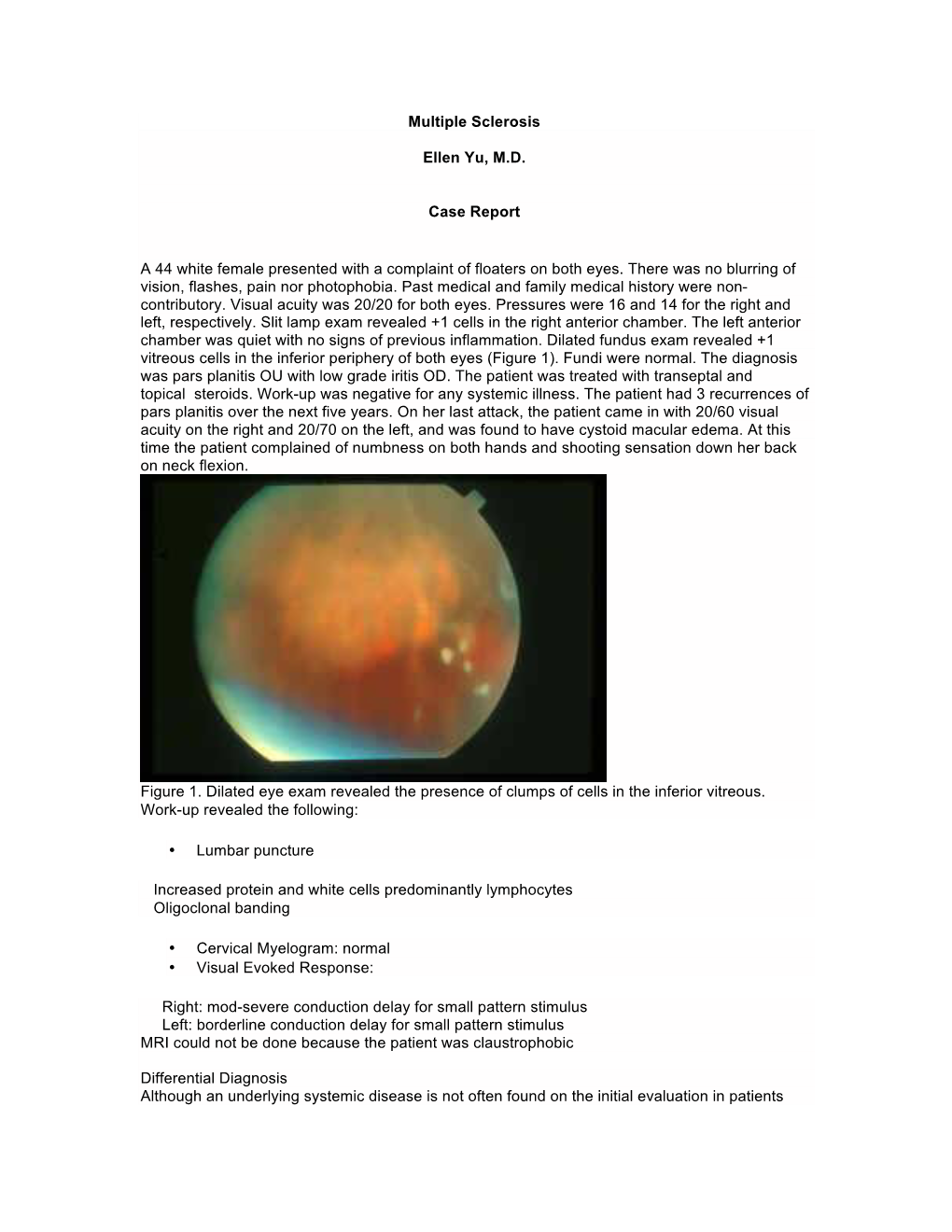 Multiple Sclerosis Ellen Yu, M.D. Case Report a 44 White Female