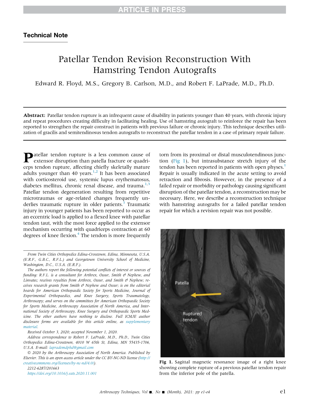 Patellar Tendon Revision Reconstruction with Hamstring Tendon Autografts Edward R