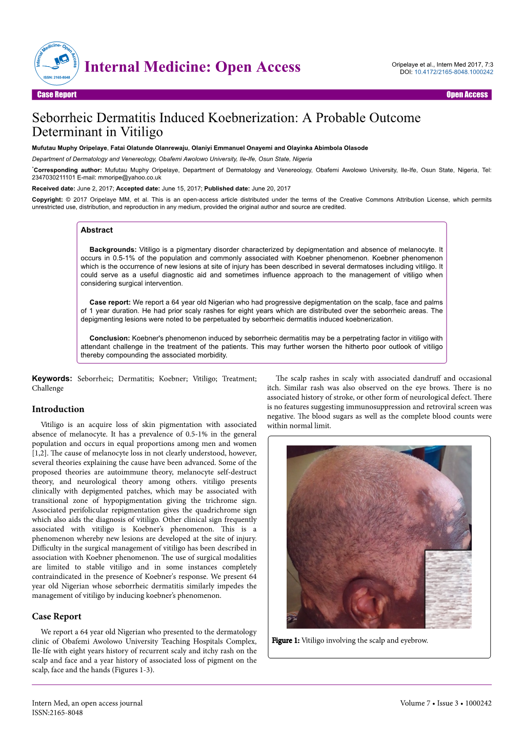 Seborrheic Dermatitis Induced Koebnerization: a Probable