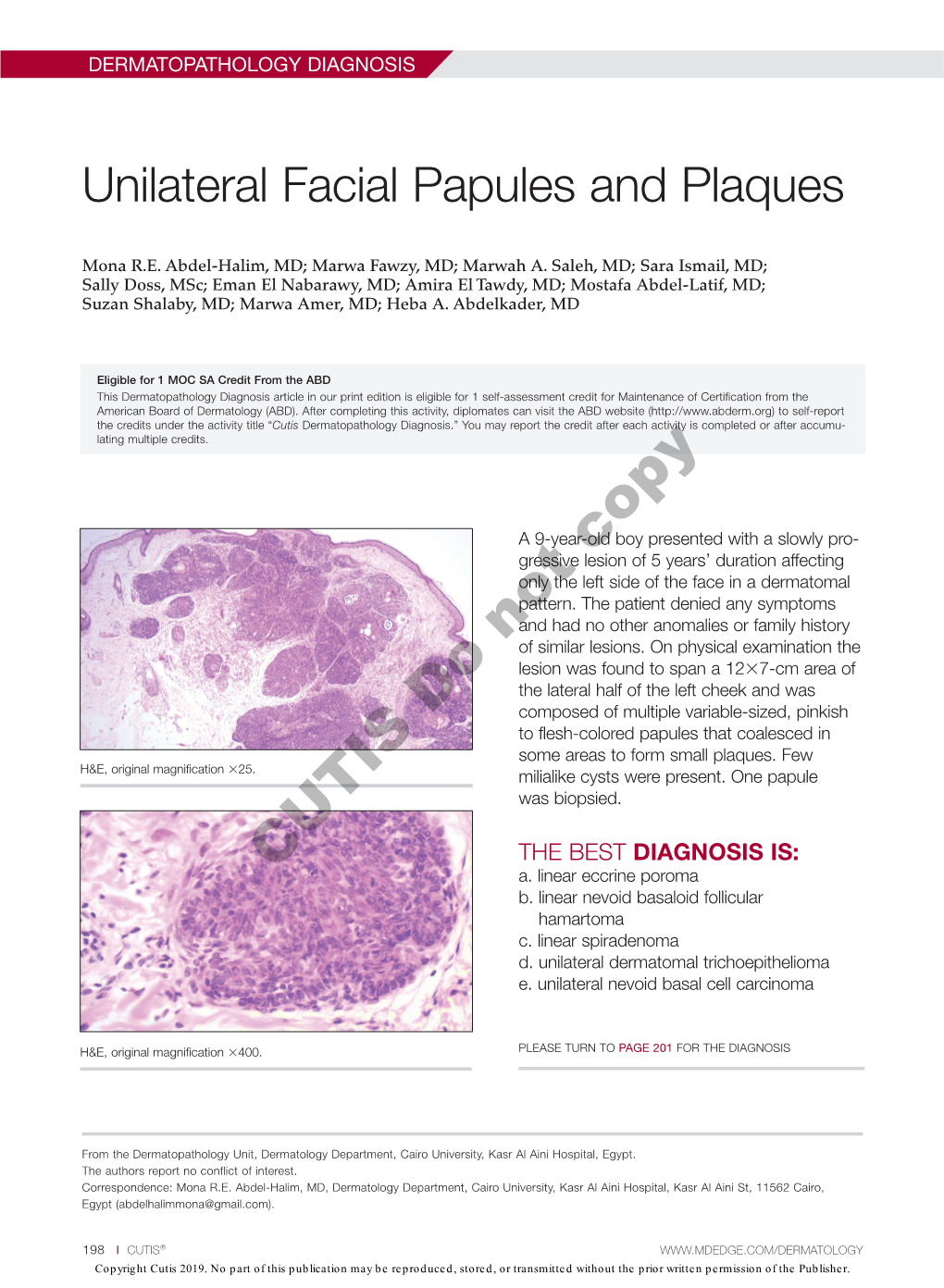 Unilateral Facial Papules and Plaques