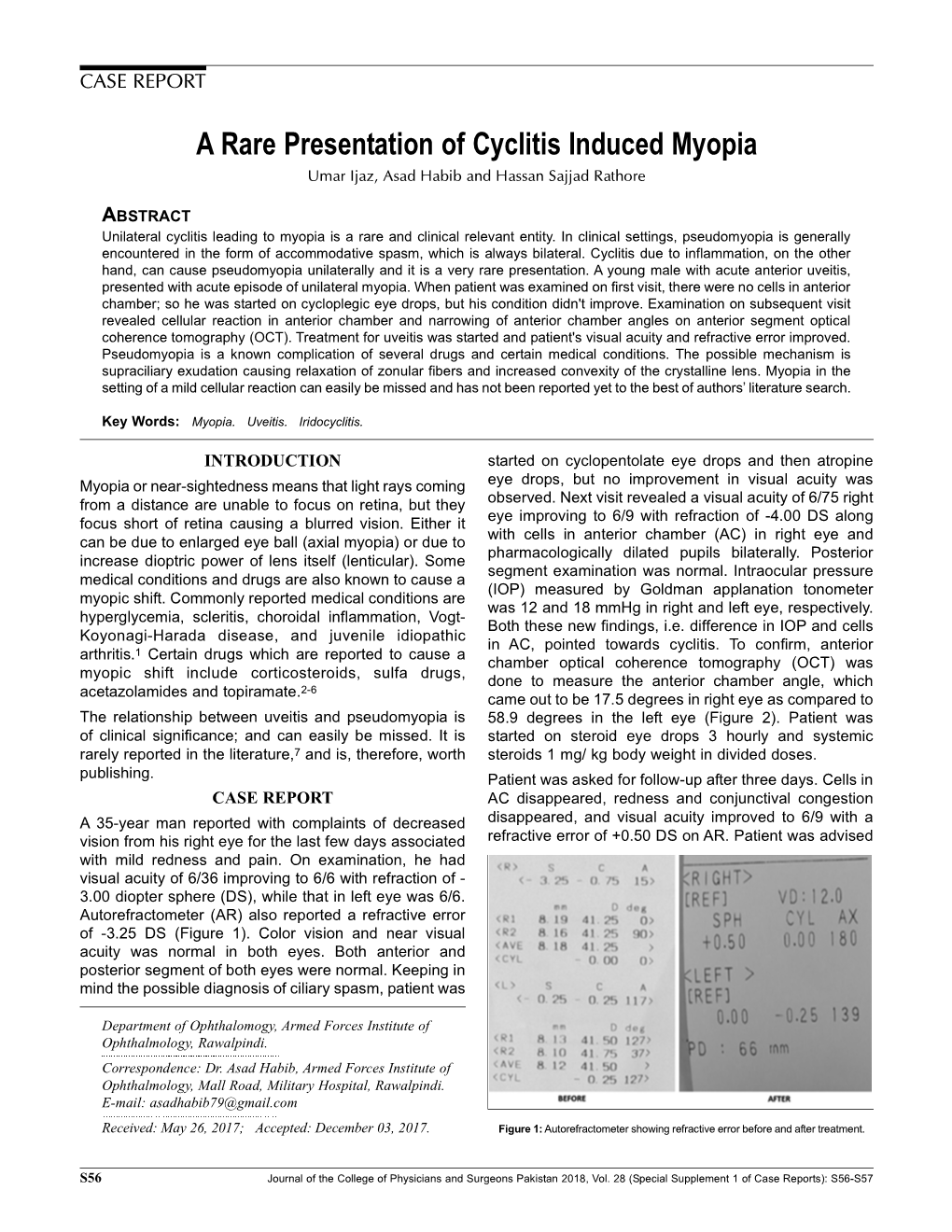 A Rare Presentation of Cyclitis Induced Myopia Umar Ijaz, Asad Habib and Hassan Sajjad Rathore