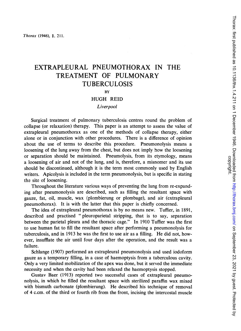 EXTRAPLEURAL PNEUMOTHORAX in the TREATMENT of PULMONARY TUBERCULOSIS by HUGH REID Liverpool