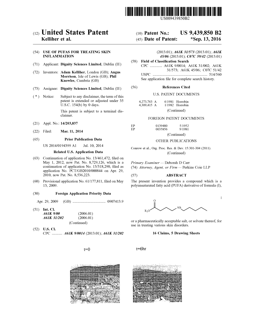 (12) United States Patent (10) Patent No.: US 9,439,850 B2 Kelliher Et Al