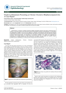 Ocular Leishmaniasis Presenting As Chronic