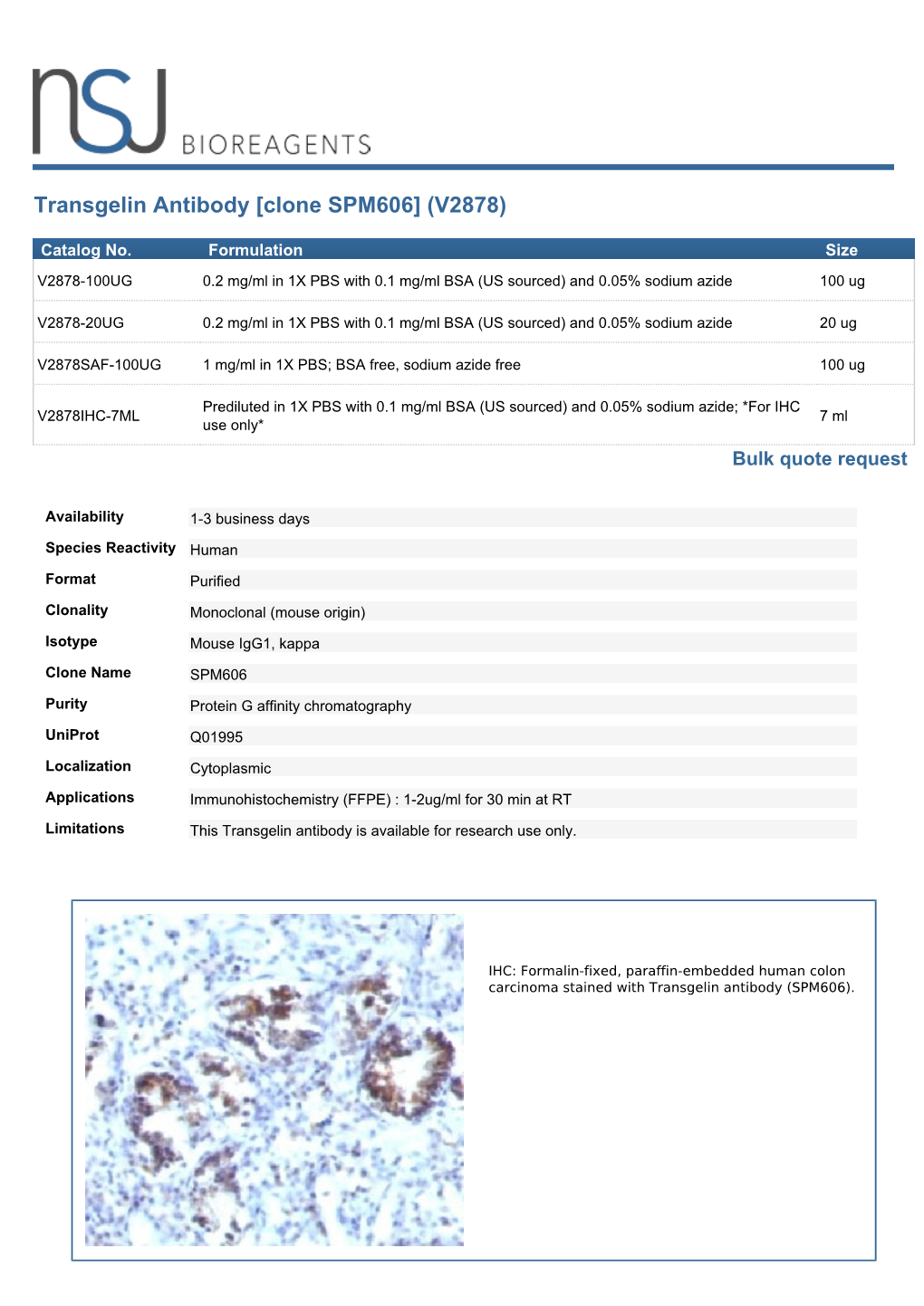 Transgelin Antibody [Clone SPM606] (V2878)