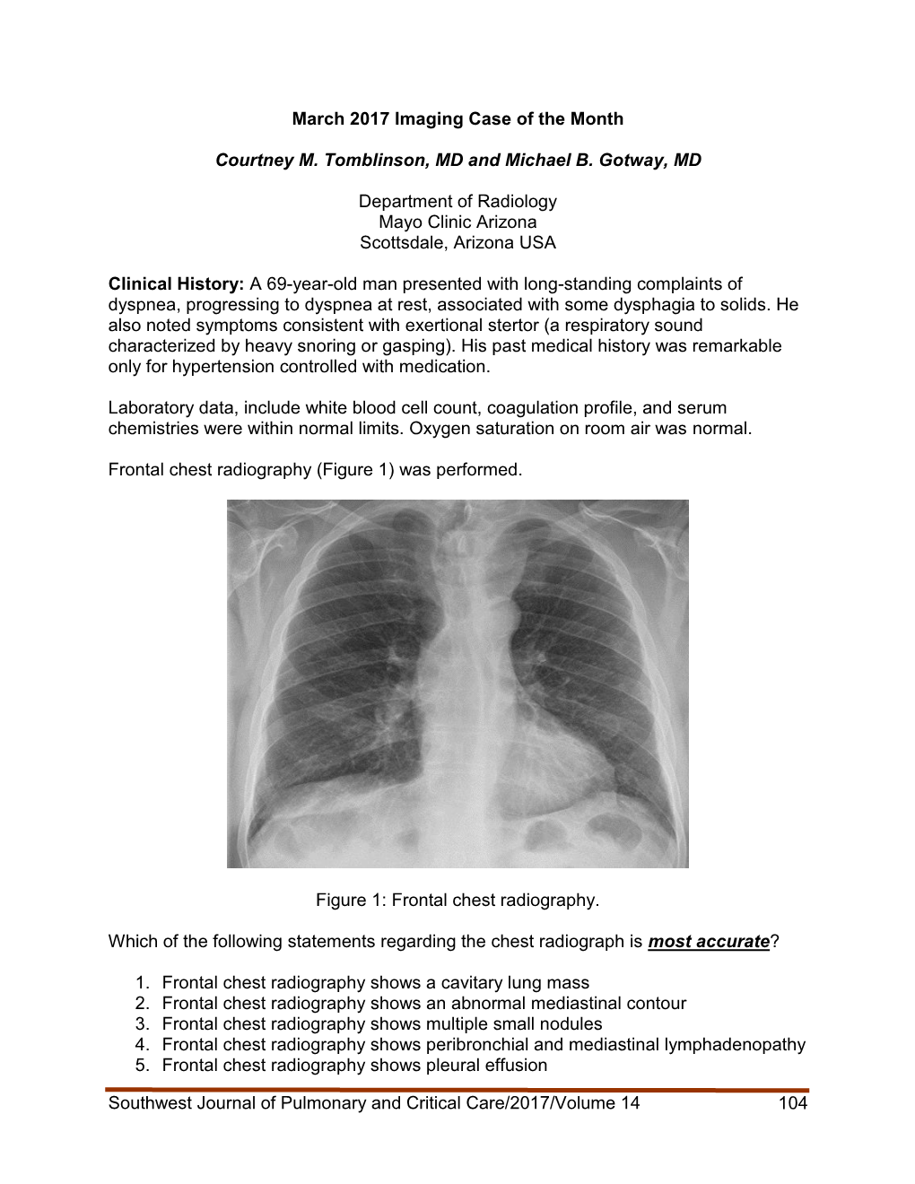 Southwest Journal of Pulmonary and Critical Care/2017/Volume 14 104 March 2017 Imaging Case of the Month Courtney M. Tomblinson