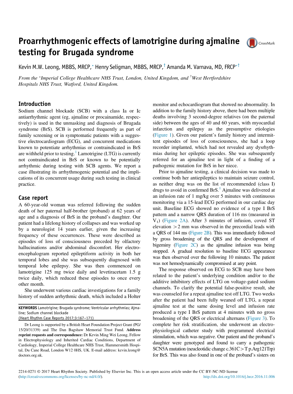 Proarrhythmogenic Effects of Lamotrigine During Ajmaline Testing for Brugada Syndrome