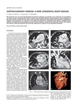 Aortopulmonary Window: a Rare Congenital Heart Disease