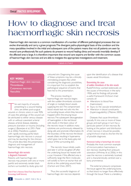 How to Diagnose and Treat Haemorrhagic Skin Necrosis