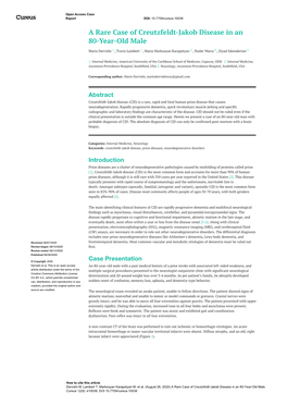 A Rare Case of Creutzfeldt-Jakob Disease in an 80-Year-Old Male