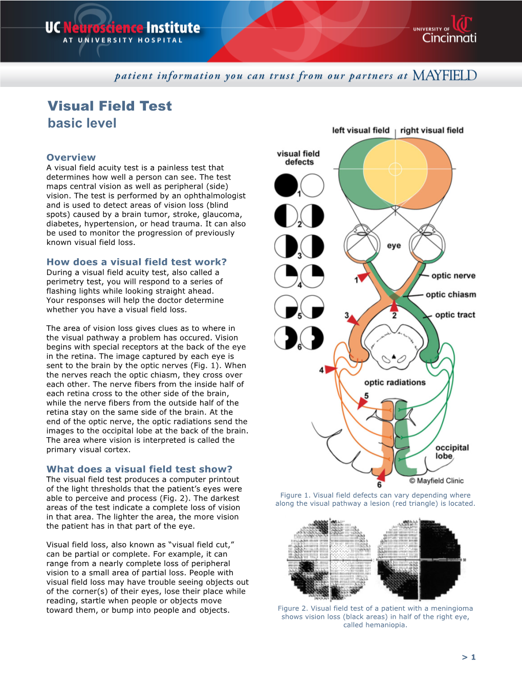 Visual Field Test Basic Level