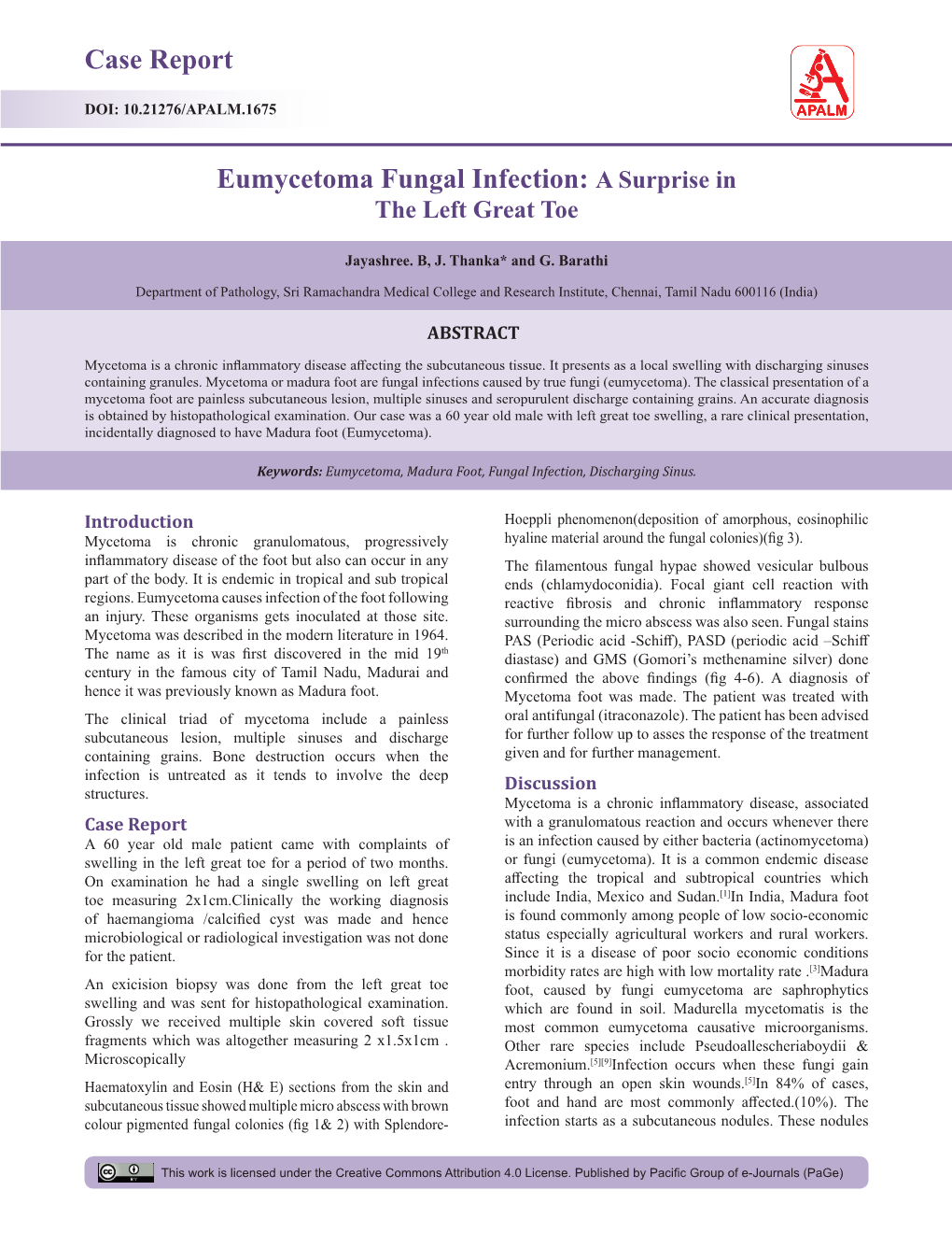 Case Report Eumycetoma Fungal Infection