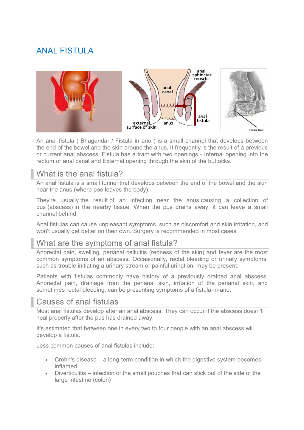 Causes of Anal Fistulas Most Anal Fistulas Develop After an Anal Abscess