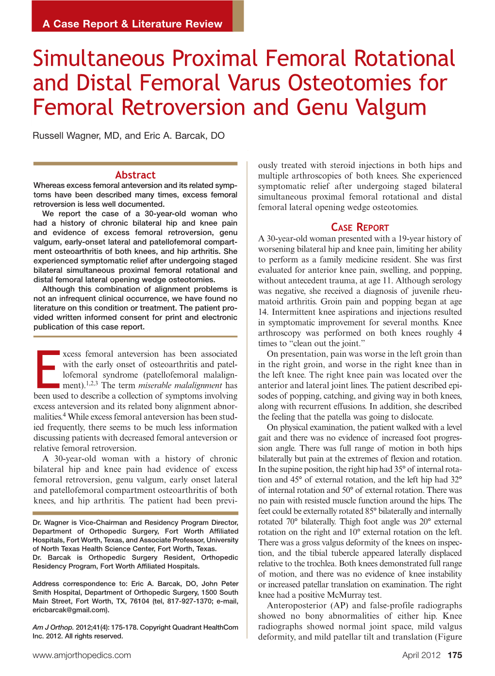 Simultaneous Proximal Femoral Rotational and Distal Femoral Varus Osteotomies for Femoral Retroversion and Genu Valgum