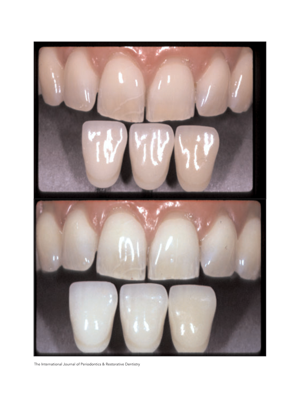 Shade Matching in Restorative Dentistry: the Science and Strategies