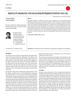 Agenesis of Common Iliac Vein Encroaching Development of Inferior Vena Cava