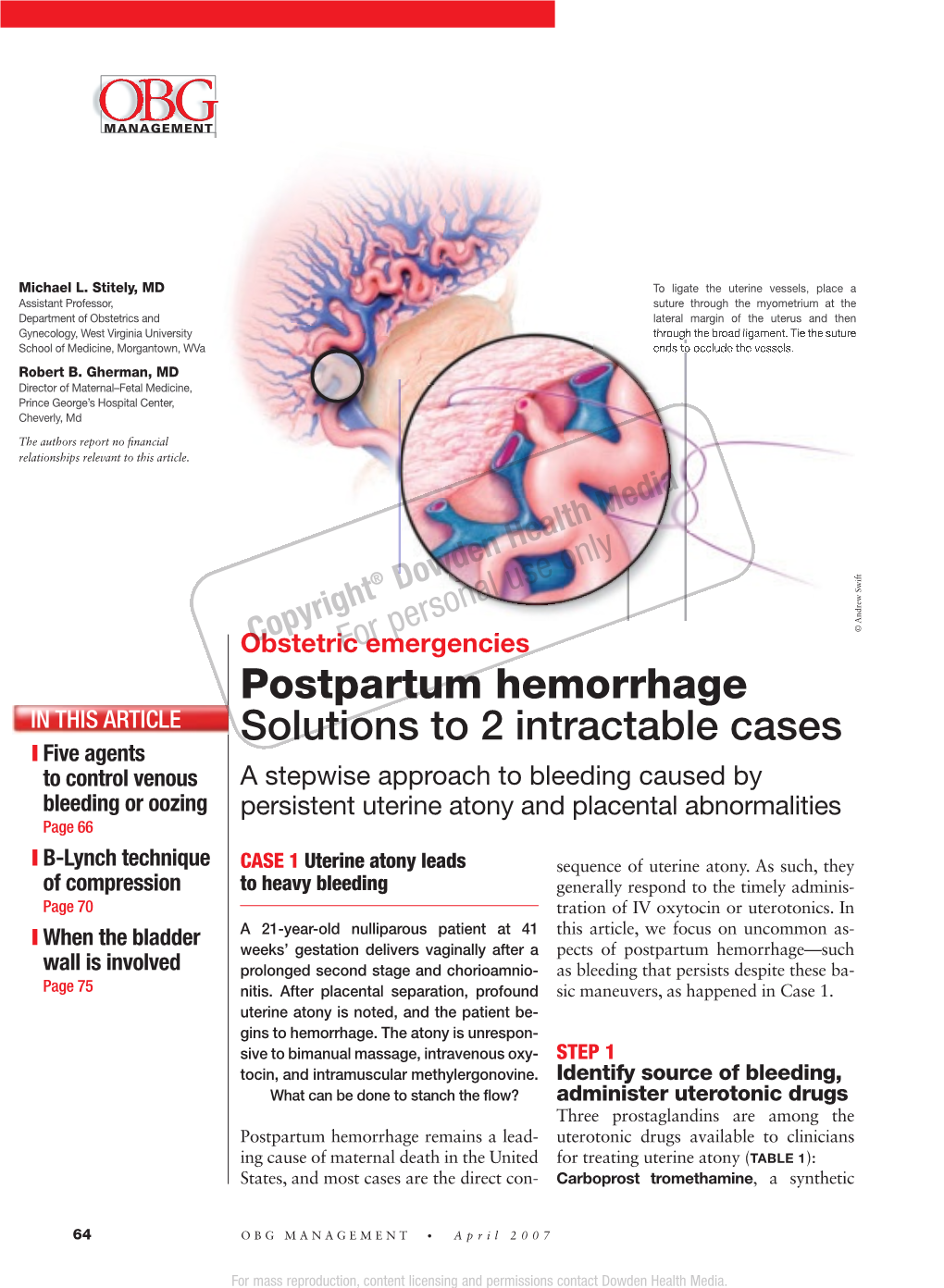 Postpartum Hemorrhage Solutions to 2 Intractable Cases