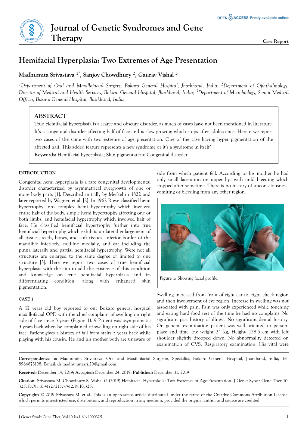 Hemifacial Hyperplasia: Two Extremes of Age Presentation