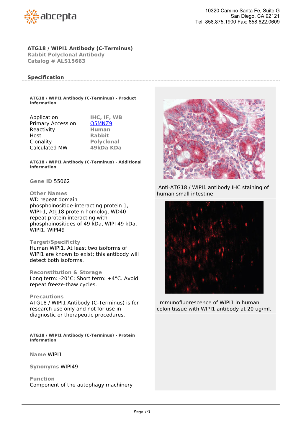 ATG18 / WIPI1 Antibody (C-Terminus) Rabbit Polyclonal Antibody Catalog # ALS15663