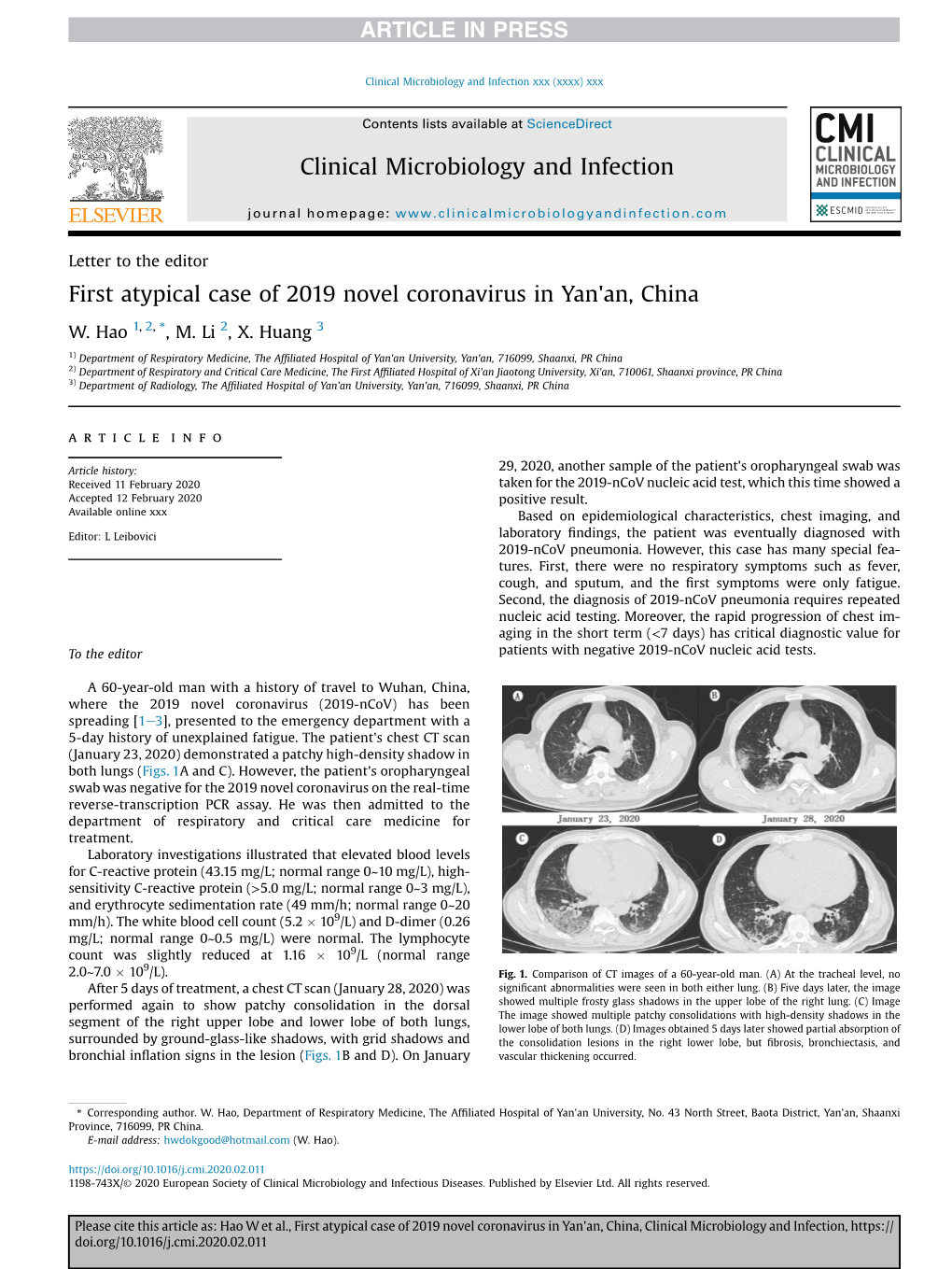 First Atypical Case of 2019 Novel Coronavirus in Yan'an, China