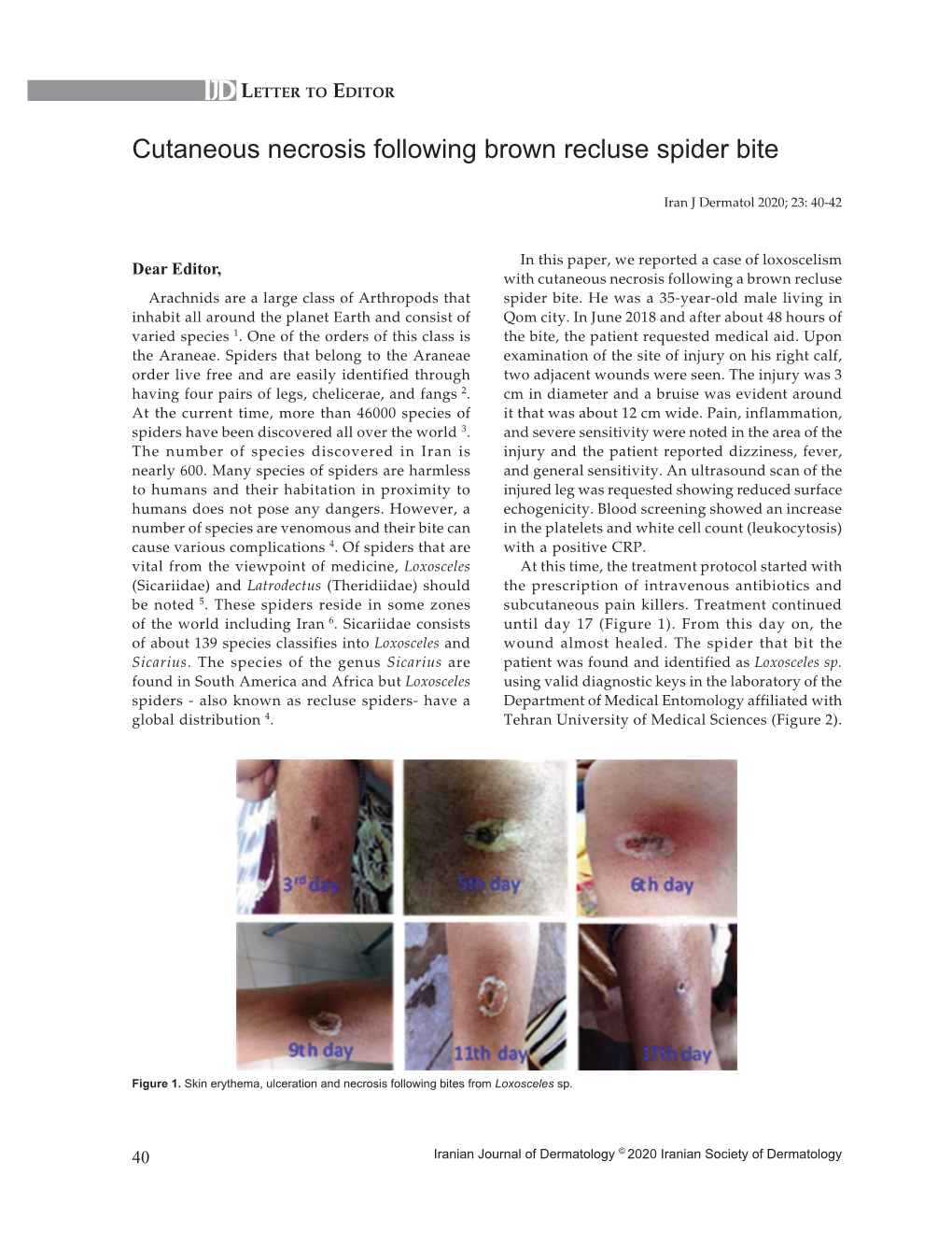 cutaneous-necrosis-following-brown-recluse-spider-bite-docslib