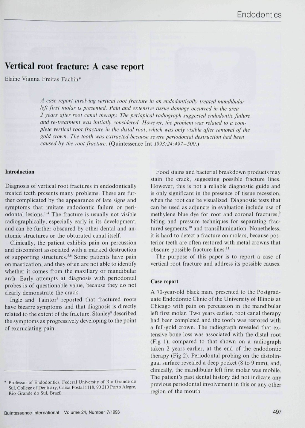 Vertical Root Fracture: a Case Report Elaine Vianna Freitas Fachin*