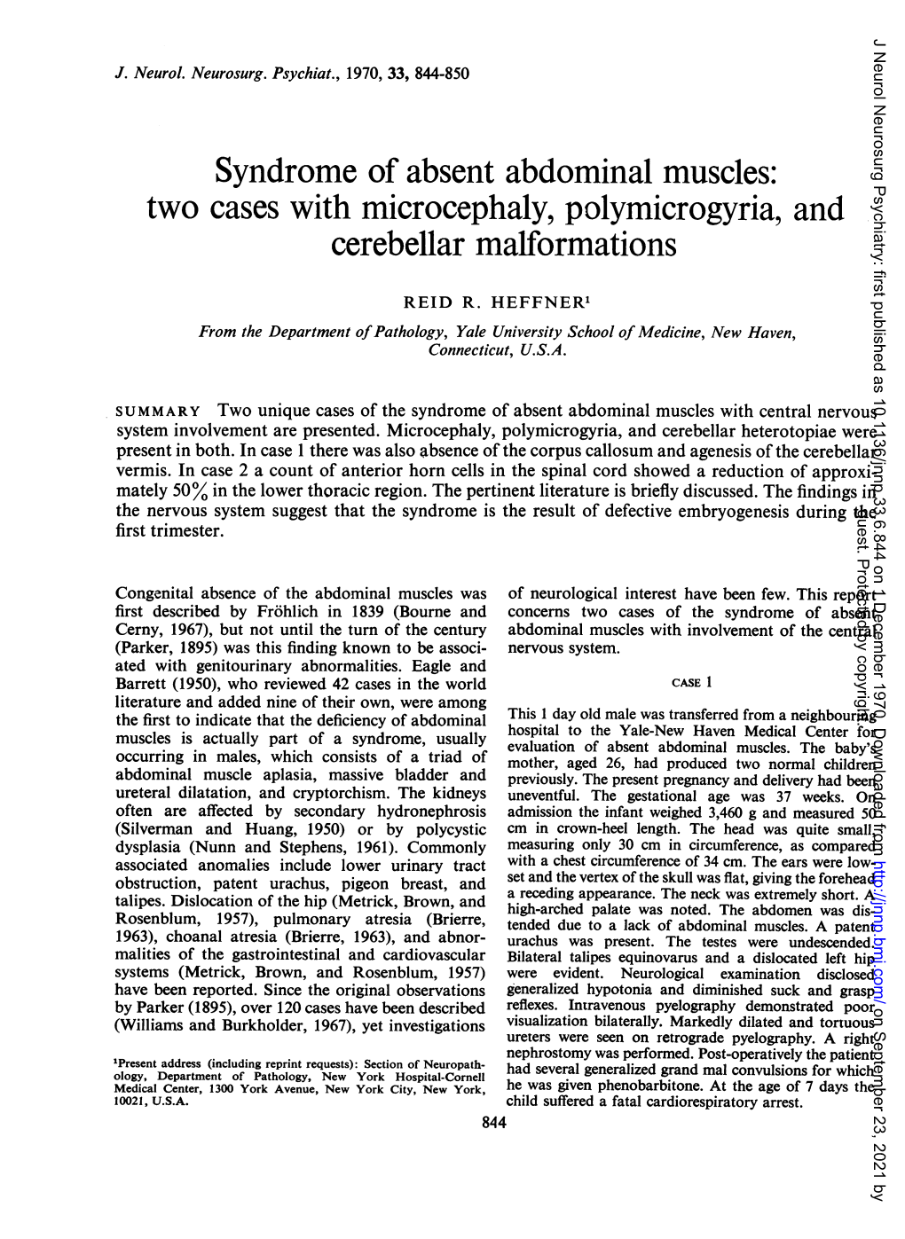 Two Cases with Microcephaly, Polymicrogyria, and Cerebellar Malformations