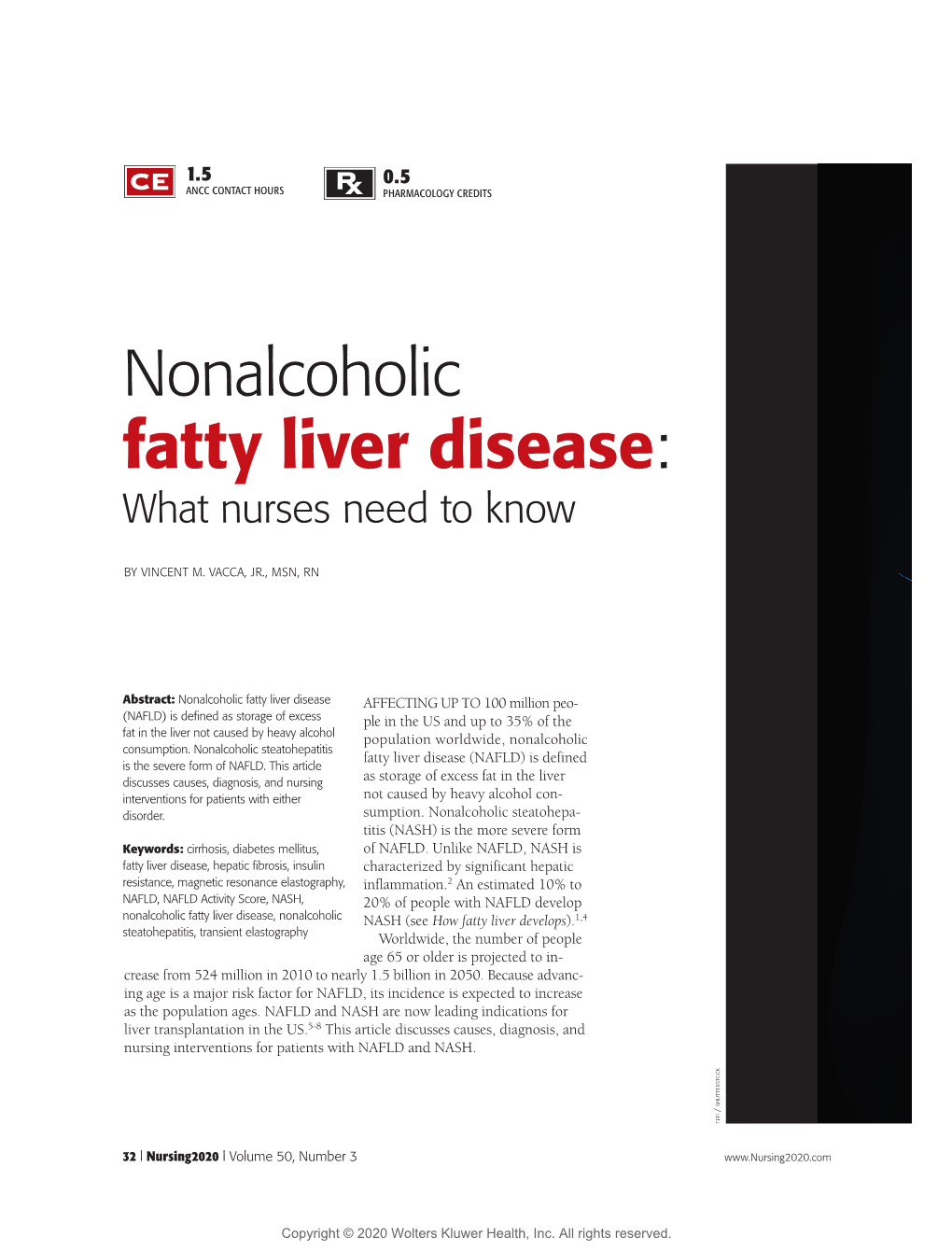 Nonalcoholic Fatty Liver Disease: What Nurses Need to Know