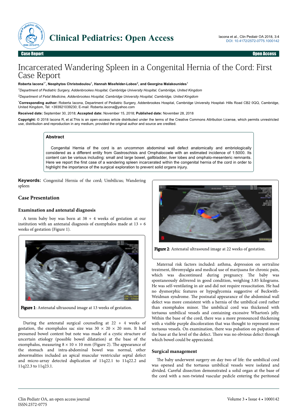 Incarcerated Wandering Spleen in a Congenital Hernia of the Cord: First Case Report