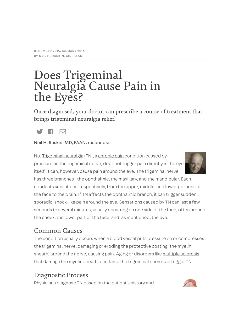 Does Trigeminal Neuralgia Cause Pain in the Eyes?