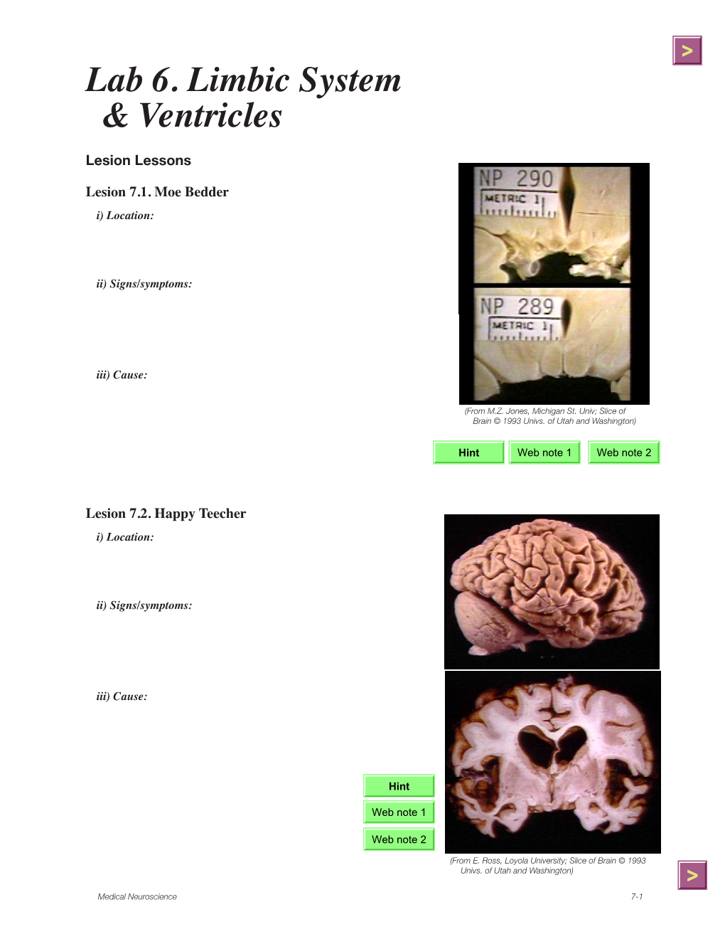 Lab 6. Limbic System & Ventricles