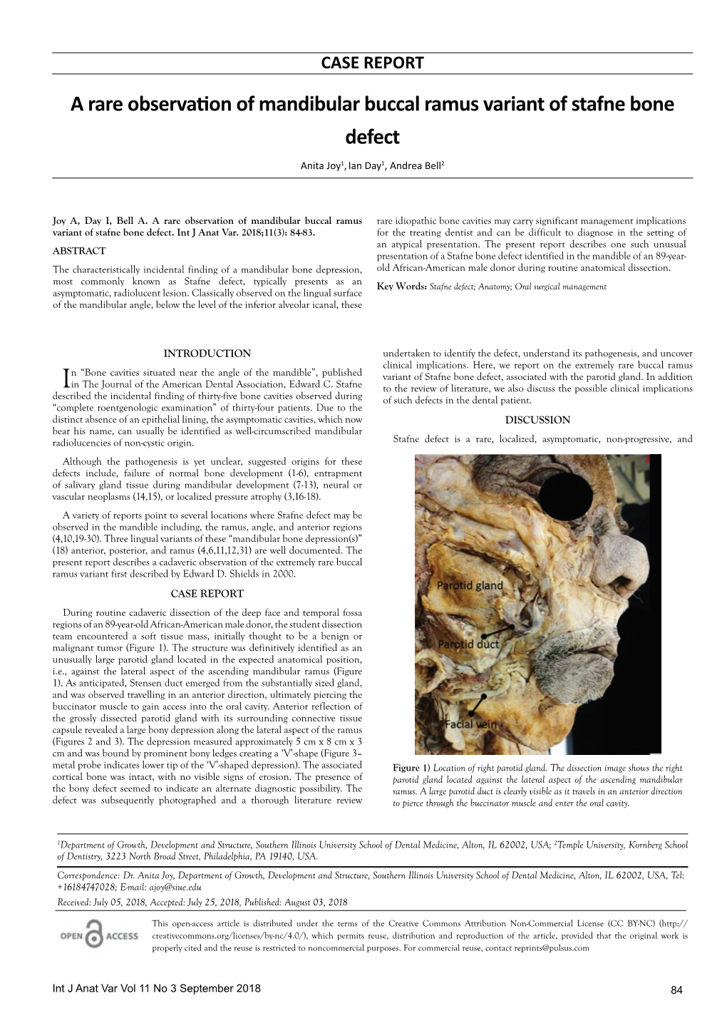 A Rare Observation of Mandibular Buccal Ramus Variant of Stafne Bone Defect