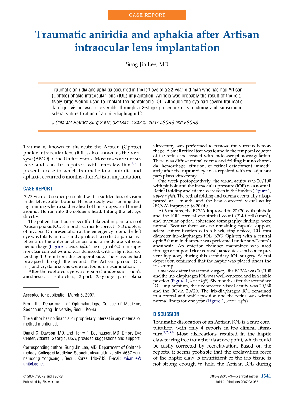 Traumatic Aniridia and Aphakia After Artisan Intraocular Lens Implantation