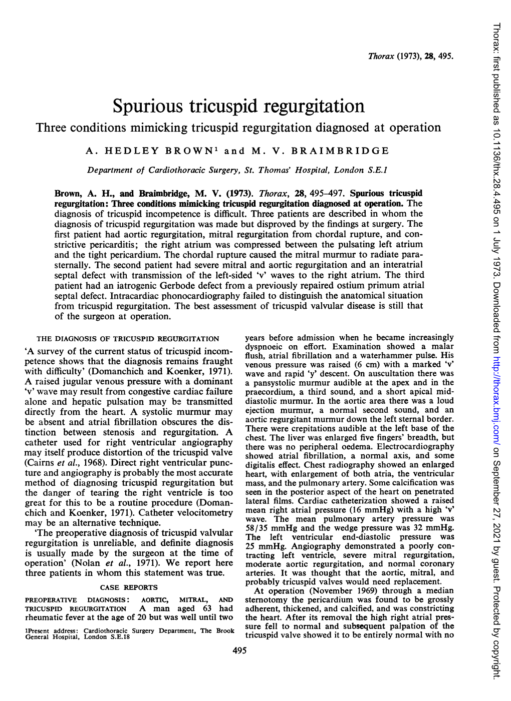 Spurious Tricuspid Regurgitation Three Conditions Mimicking Tricuspid Regurgitation Diagnosed at Operation A