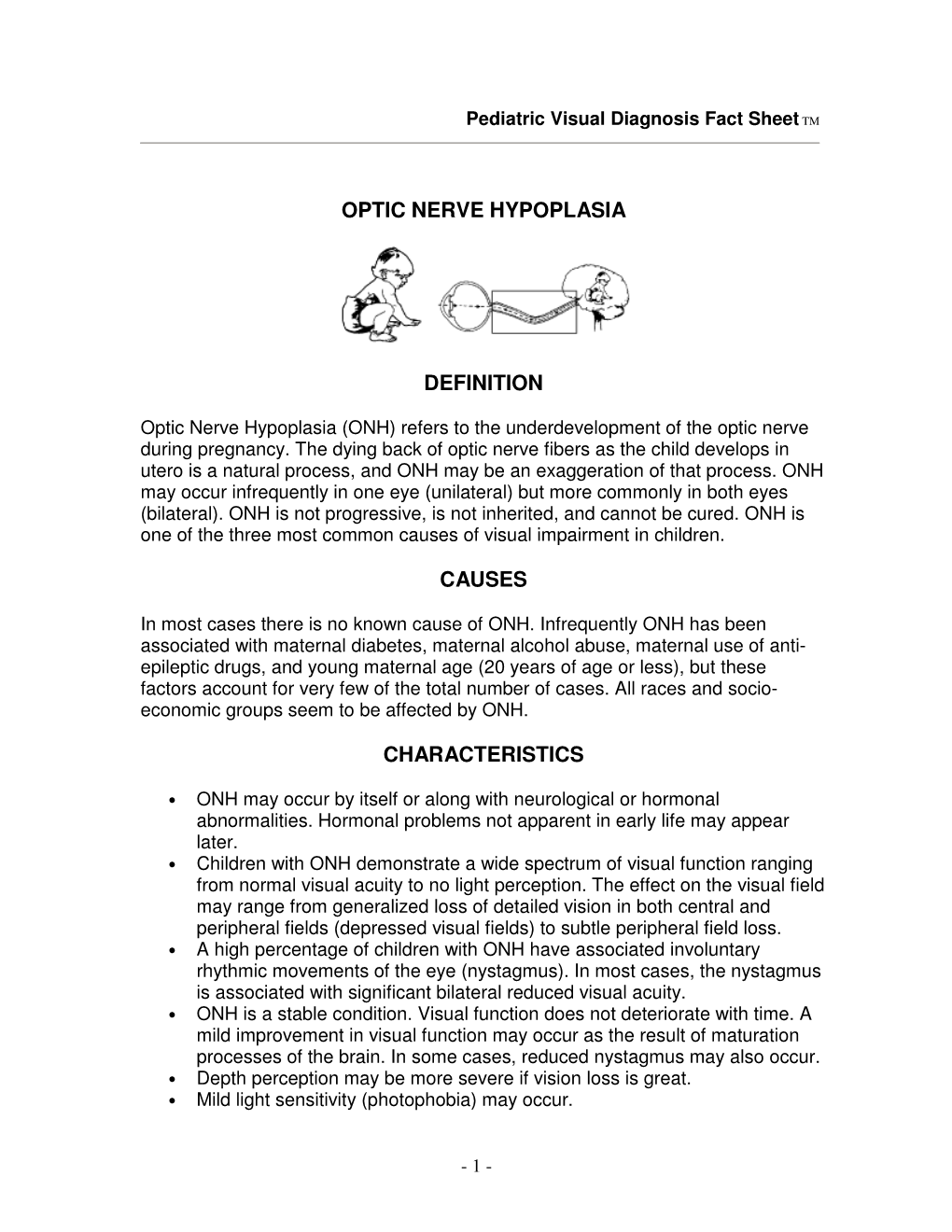 Optic Nerve Hypoplasia (ONH) Refers to the Underdevelopment of the Optic Nerve During Pregnancy