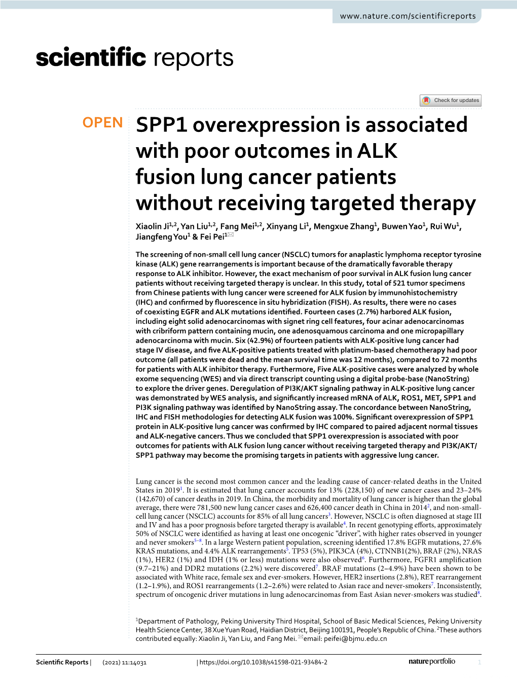 SPP1 Overexpression Is Associated with Poor Outcomes in ALK Fusion