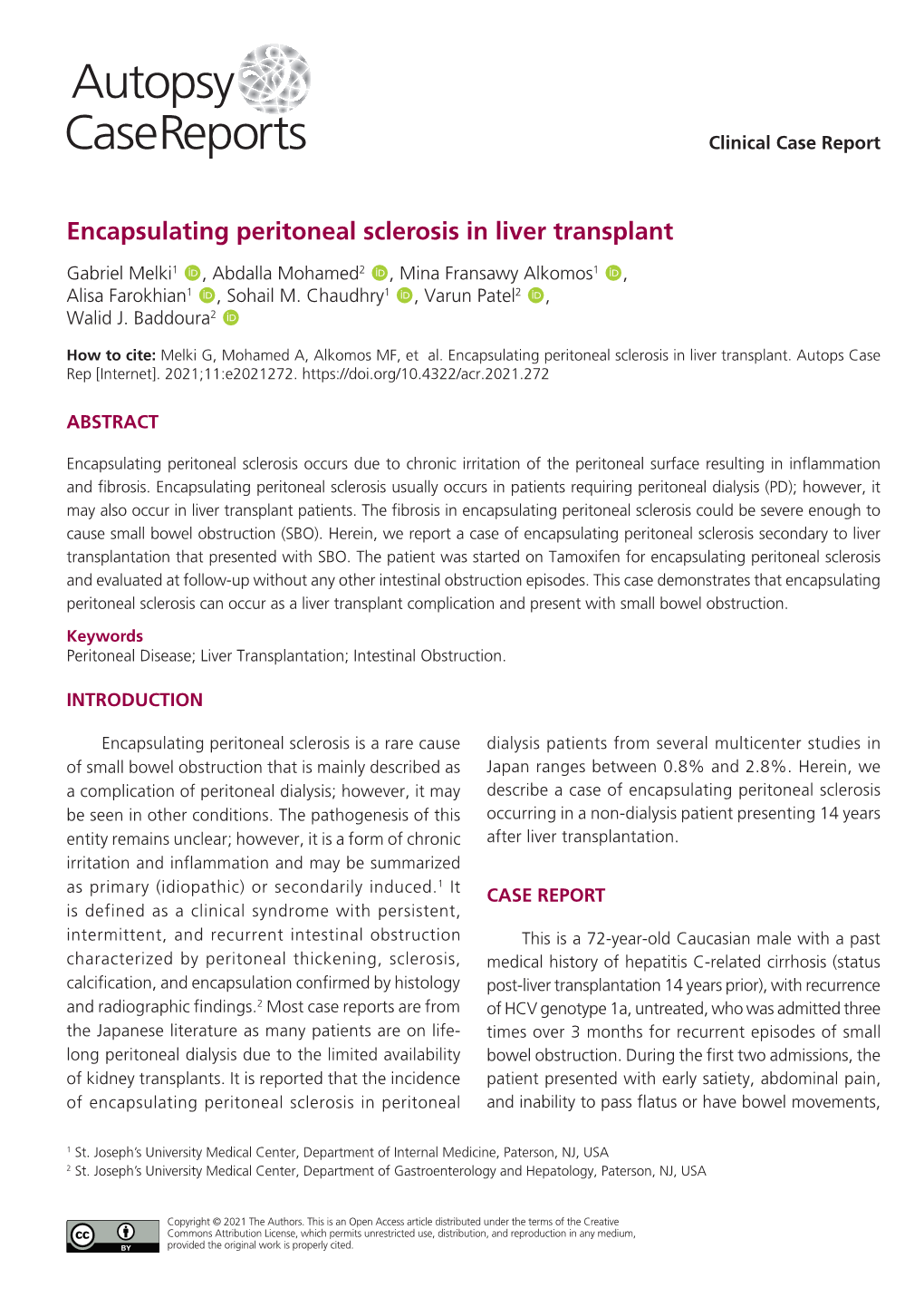 Encapsulating Peritoneal Sclerosis in Liver Transplant