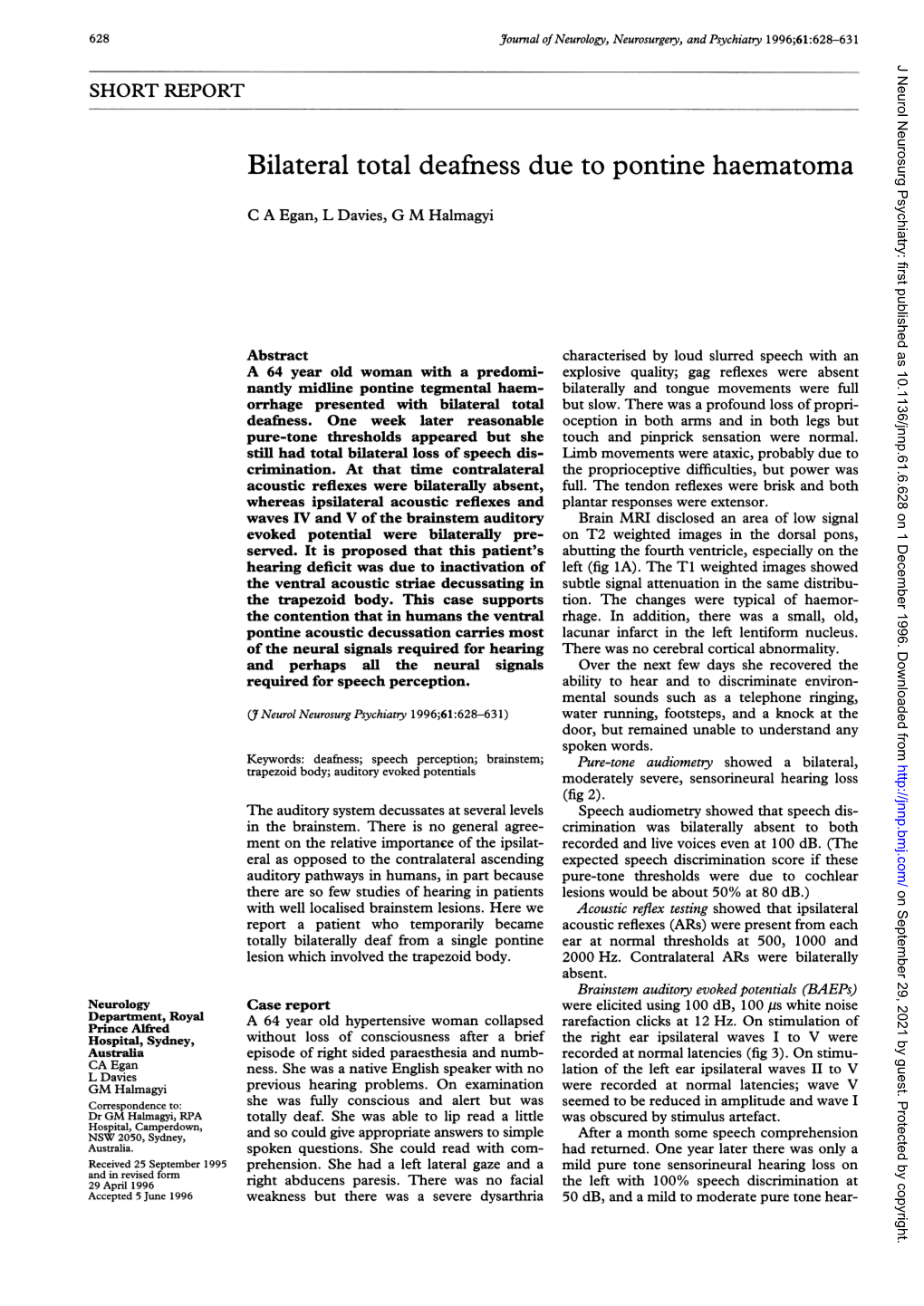 Bilateral Total Deafness Due to Pontine Haematoma