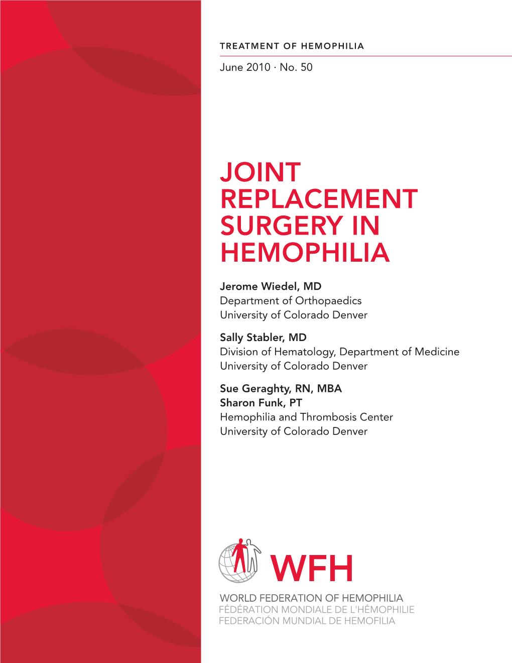 Joint Replacement Surgery in Hemophilia