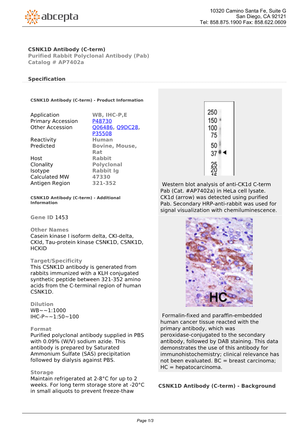 CSNK1D Antibody (C-Term) Purified Rabbit Polyclonal Antibody (Pab) Catalog # Ap7402a