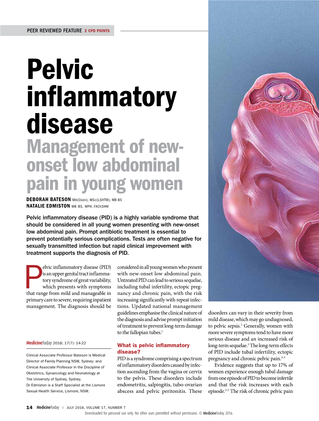 Pelvic Inflammatory Disease