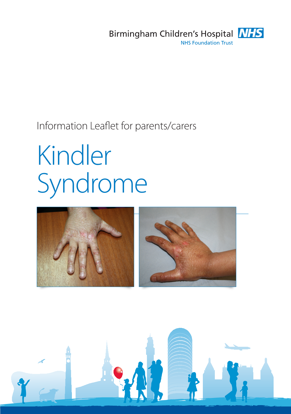 Kindler Syndrome Kindler Syndrome