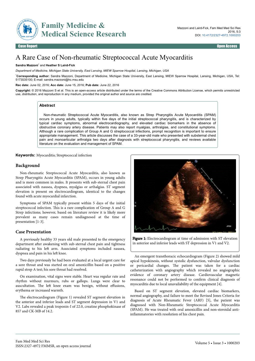 A Rare Case of Non-Rheumatic Streptococcal Acute Myocarditis