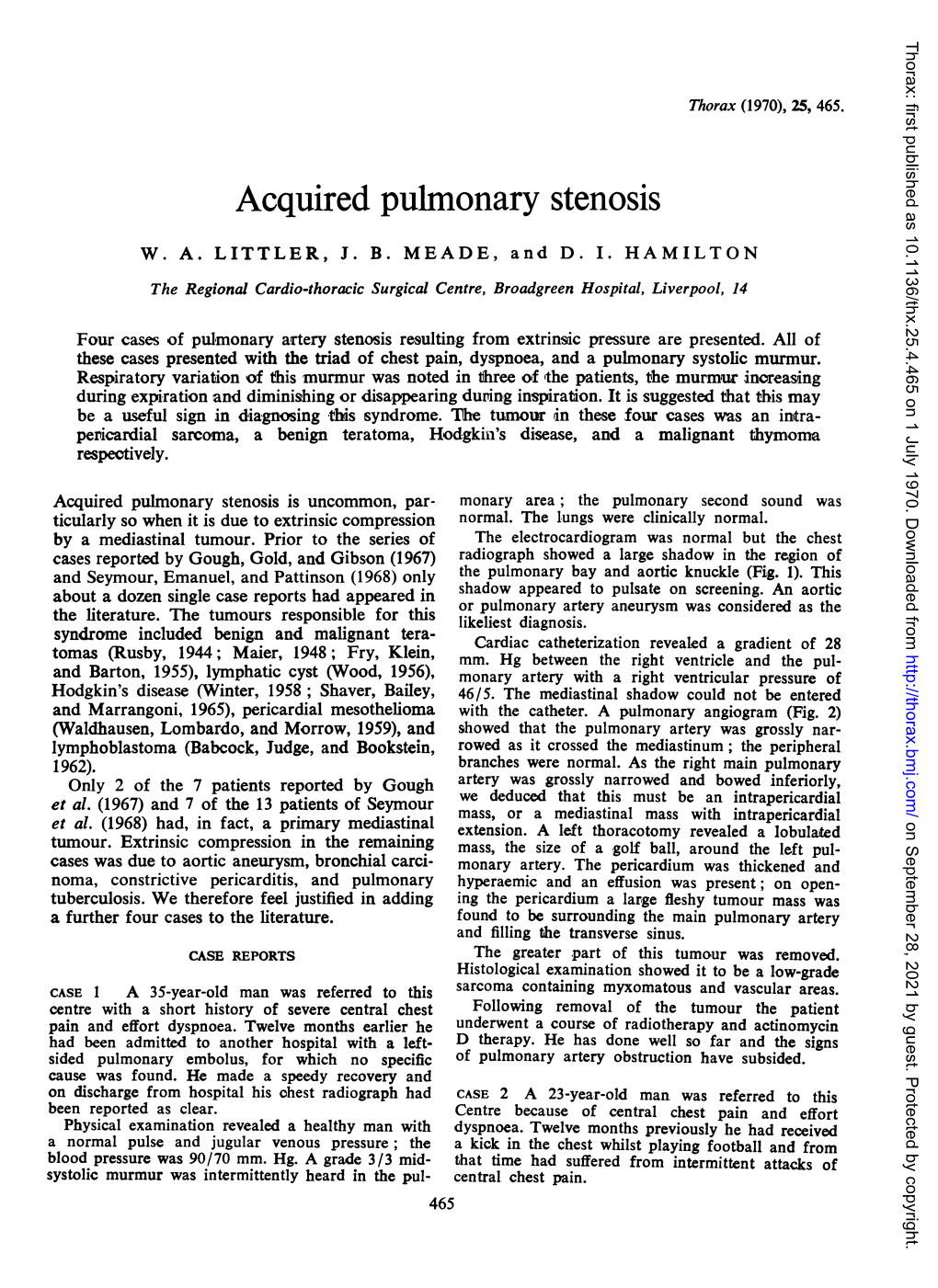 Acquired Pulmonary Stenosis