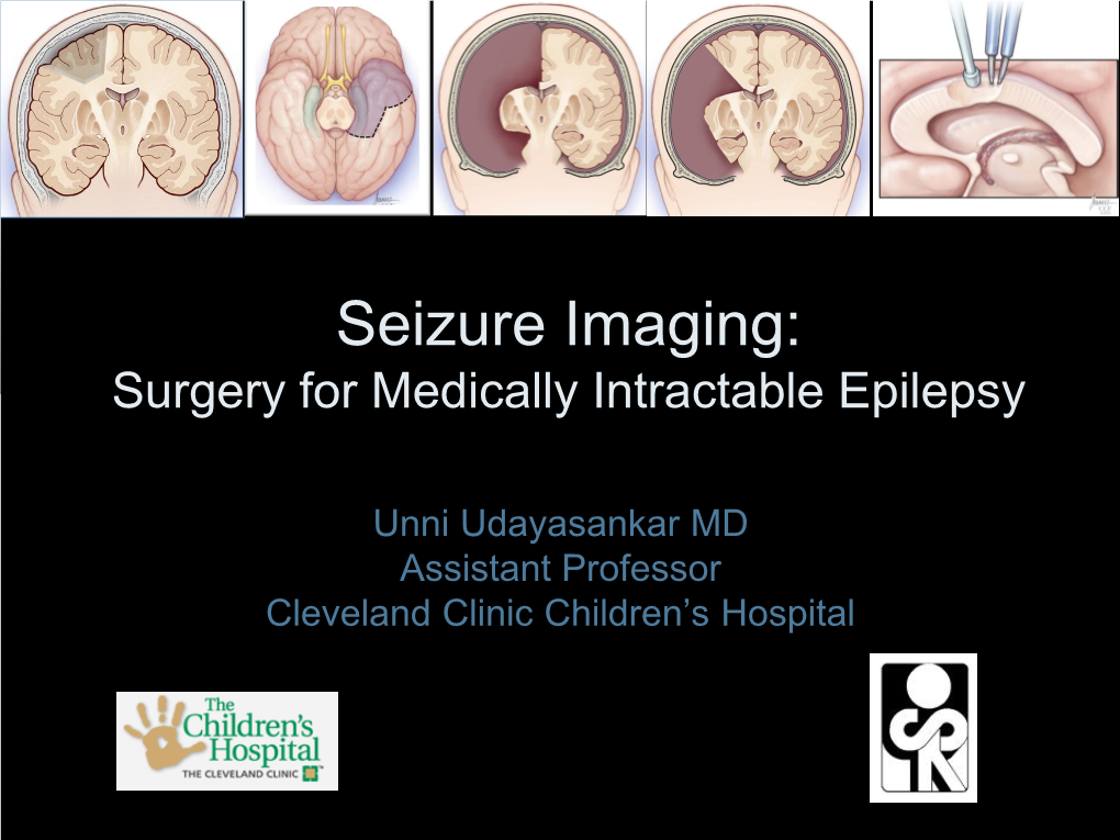 Seizure Imaging: Surgery for Medically Intractable Epilepsy