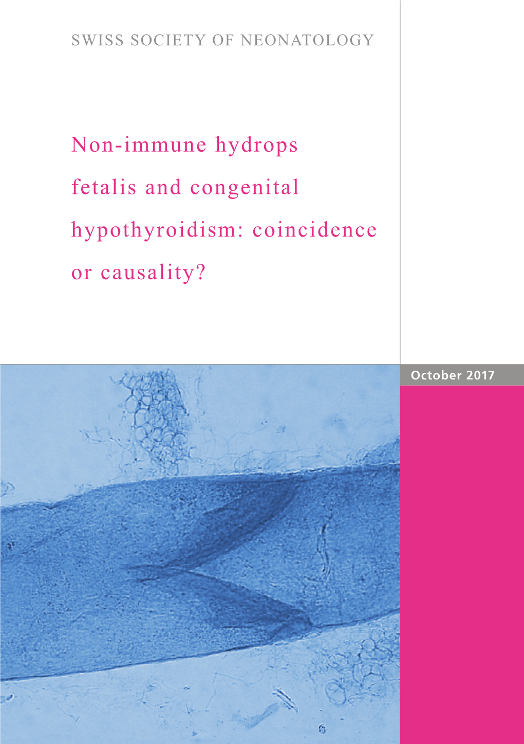 Non-Immune Hydrops Fetalis and Congenital Hypothyroidism: Coincidence Or Causality?